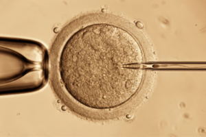 fertilização in vitro em Curitiba