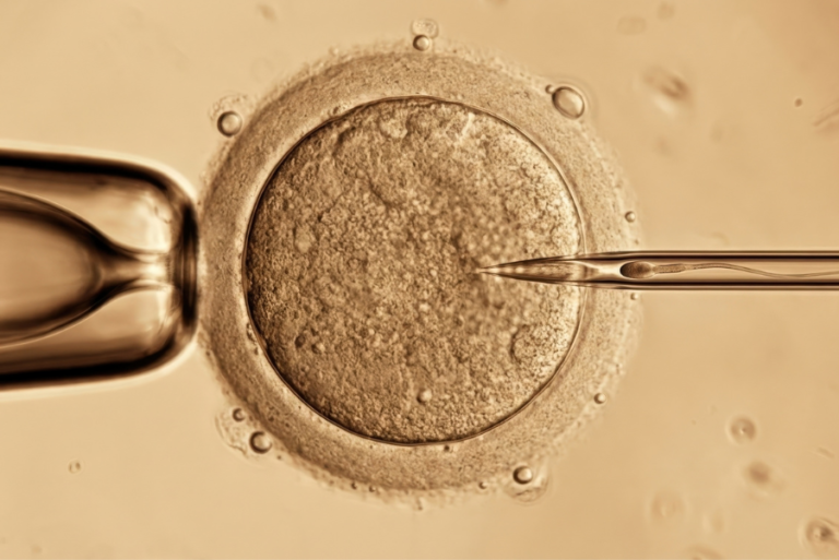 fertilização in vitro em Curitiba