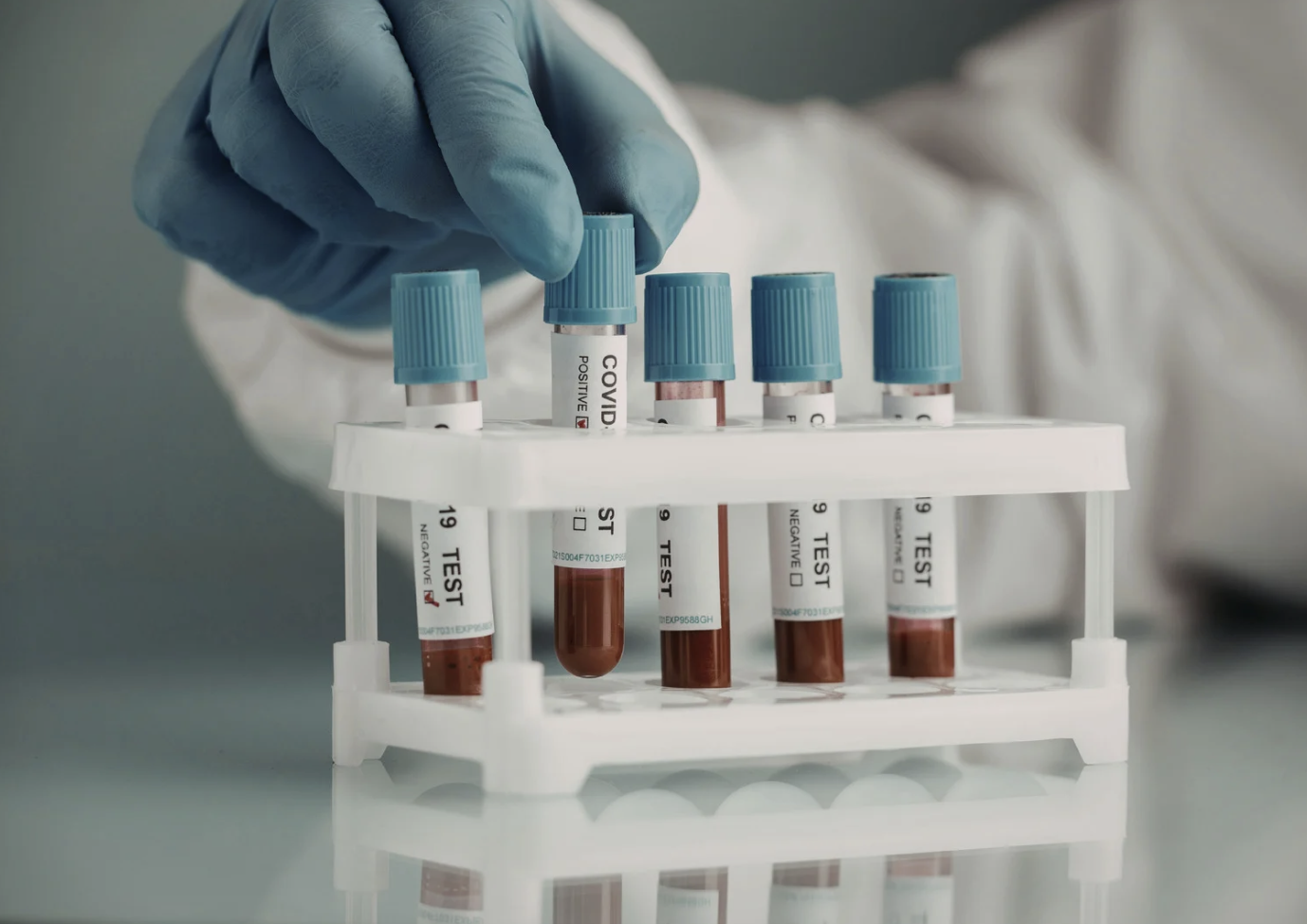 exames antes da fertilização in vitro